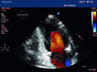 TM5 immagini Pagina 21 Immagine 0002