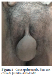 mutilazioni genitali Fig 5