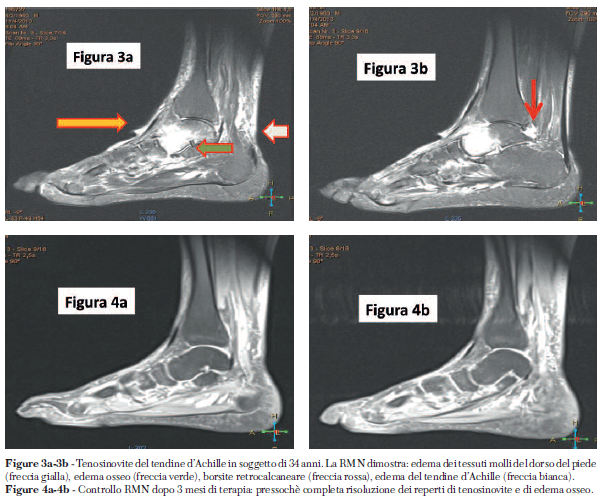 pag 10 Fig 3a 3b 4a 4b