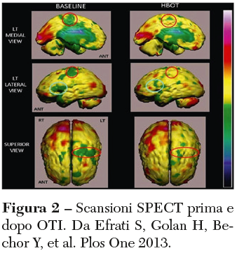 ossigenoterapia Fig 2