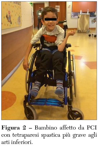 paresi Fig 2