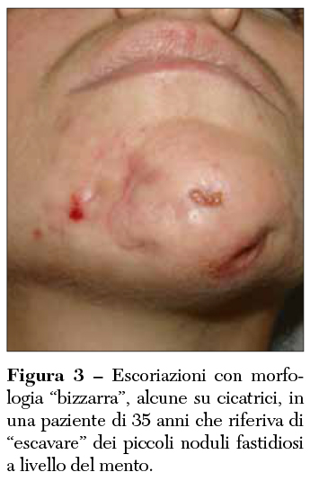 Fig 3 Morfologia bizzarra