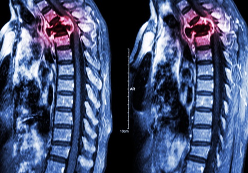 oncologia ortopedica