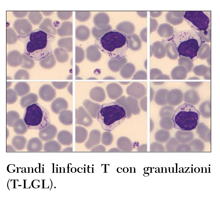 Fig 4 Cesari