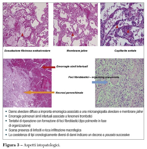Fig 3 Bonuccelli