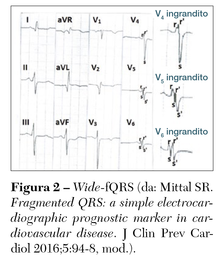 Fig 2 Stefani
