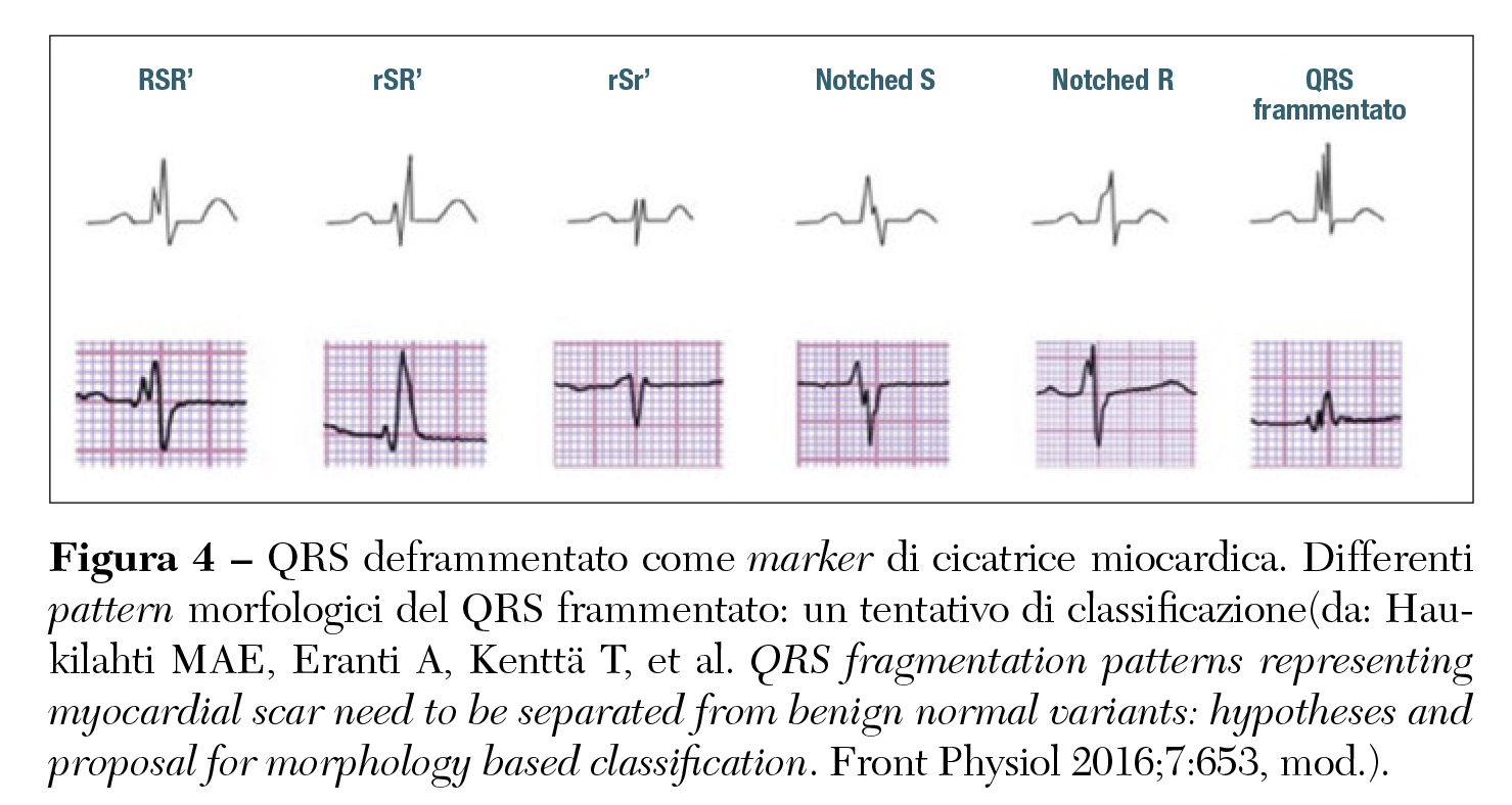 Fig 4 Stefani