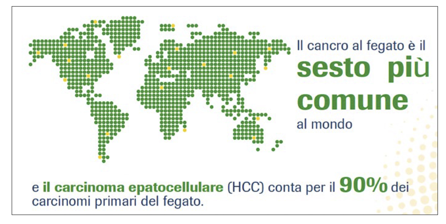 Focus 1 opinioni a confronto